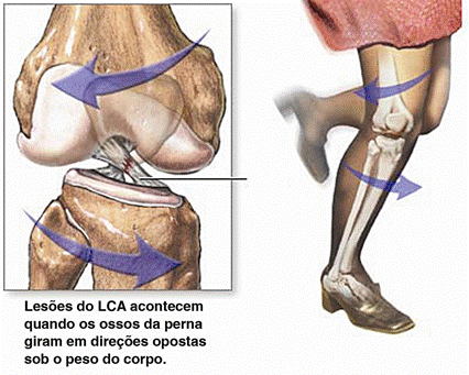 Jogar Operate Now Cirurgia no Joelho no